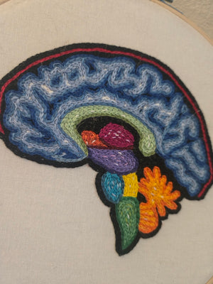 Brain MRI