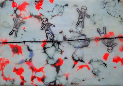 An Unfortunate Occurrence Happened at the Trampoline Today