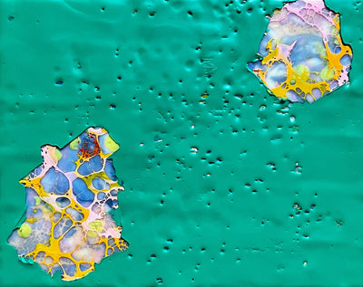 14 Years Plus Connective Tissues of The 80's